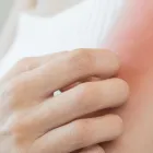 アレルギー対策